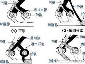 氣量狹小|氣量的英文單字，氣量的英文是什麽